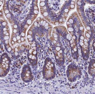 Immunohistochemistry-Paraffin: SLC24A6 Antibody [NBP1-83607]