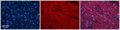 Immunohistochemistry: SLC25A12 Antibody [NBP1-59556]