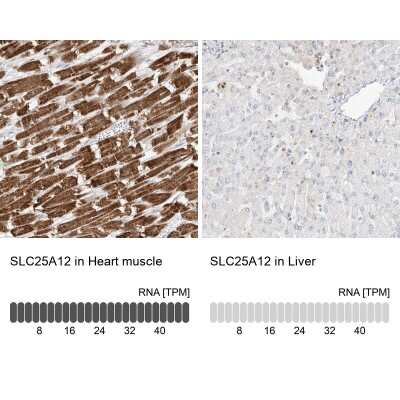 Immunohistochemistry-Paraffin: SLC25A12 Antibody [NBP2-38249]