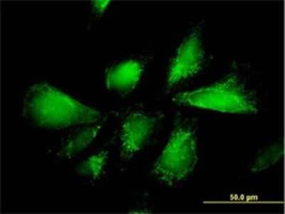 Immunocytochemistry/ Immunofluorescence: SLC25A13 Antibody (4F4) [H00010165-M01]