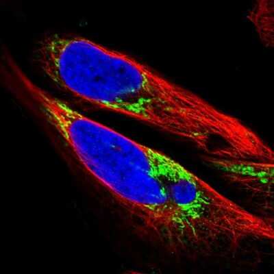 Immunocytochemistry/ Immunofluorescence: SLC25A13 Antibody [NBP1-89019]