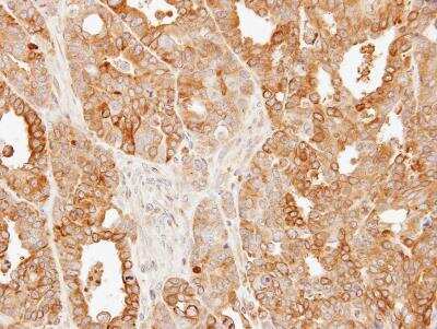 Immunohistochemistry-Paraffin: SLC25A13 Antibody [NBP1-33380]