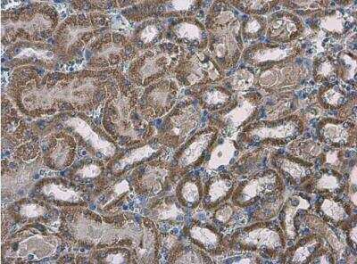 Immunohistochemistry-Paraffin: SLC25A13 Antibody [NBP1-33380]