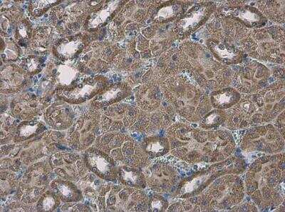 Immunohistochemistry-Paraffin: SLC25A13 Antibody [NBP1-33380]