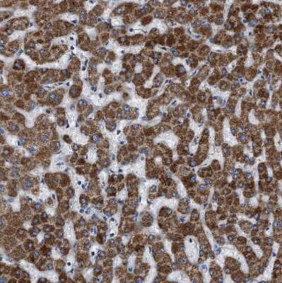 Immunohistochemistry-Paraffin: SLC25A13 Antibody [NBP1-89019]