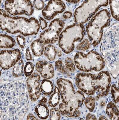 Immunohistochemistry-Paraffin: SLC25A13 Antibody [NBP1-89019]