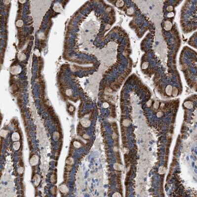 Immunohistochemistry-Paraffin: SLC25A13 Antibody [NBP1-89019]