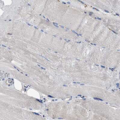 Immunohistochemistry-Paraffin: SLC25A13 Antibody [NBP1-89019]
