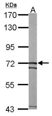 Western Blot: SLC25A13 Antibody [NBP1-33380]