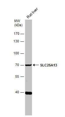 Western Blot: SLC25A13 Antibody [NBP1-33380]