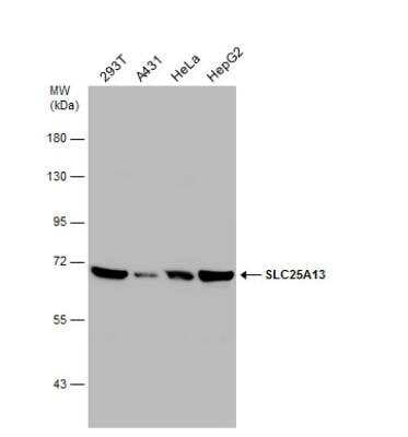 Western Blot: SLC25A13 Antibody [NBP1-33380]