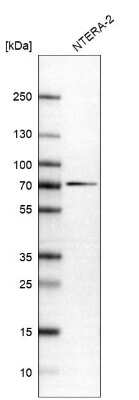 Western Blot: SLC25A13 Antibody [NBP1-89019]