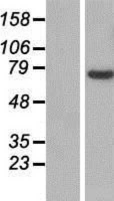 Western Blot: SLC25A13 Overexpression Lysate [NBP2-07365]
