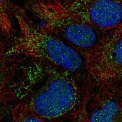 Immunocytochemistry/ Immunofluorescence: SLC25A18 Antibody [NBP3-17540]
