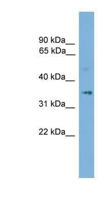 Western Blot: SLC25A19 Antibody [NBP1-80528]