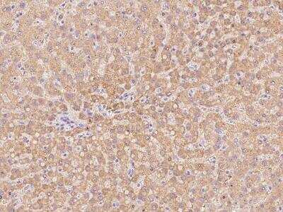 Immunohistochemistry-Paraffin: SLC25A2 Antibody [NBP3-06289]