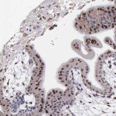 Immunohistochemistry-Paraffin: SLC25A21 Antibody [NBP1-82493]