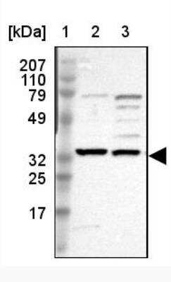 Western Blot: SLC25A21 Antibody [NBP1-82493]