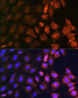 Immunocytochemistry/ Immunofluorescence: SLC25A22 Antibody - Azide and BSA Free [NBP2-94069]