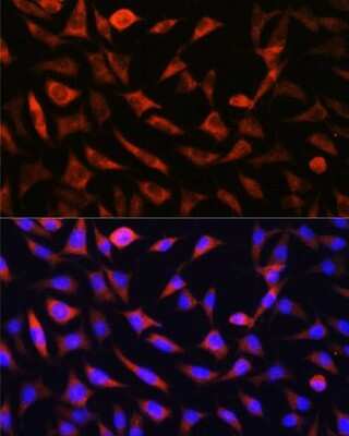 Immunocytochemistry/ Immunofluorescence: SLC25A22 Antibody - Azide and BSA Free [NBP2-94069]