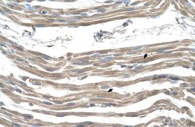 Immunohistochemistry-Paraffin: SLC25A22 Antibody [NBP1-59603]