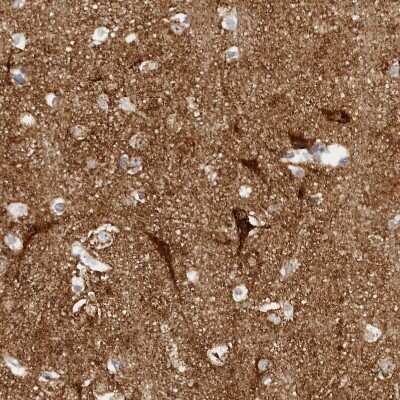 Immunohistochemistry-Paraffin: SLC25A22 Antibody [NBP1-84880]