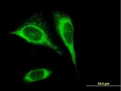 Immunocytochemistry/ Immunofluorescence: SLC25A24 Antibody [H00029957-B01P]