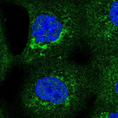 Immunocytochemistry/ Immunofluorescence: SLC25A24 Antibody [NBP1-89049]