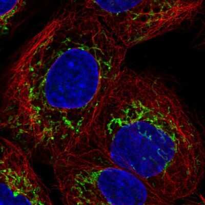 Immunocytochemistry/ Immunofluorescence: SLC25A24 Antibody [NBP2-57669]
