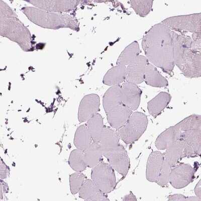 Immunohistochemistry-Paraffin: SLC25A24 Antibody [NBP2-57669]