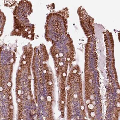 Immunohistochemistry-Paraffin: SLC25A24 Antibody [NBP2-57669]