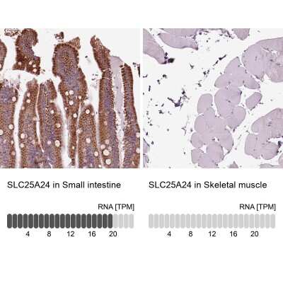 Immunohistochemistry-Paraffin: SLC25A24 Antibody [NBP2-57669]