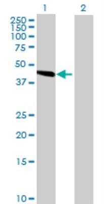 Western Blot: SLC25A24 Antibody [H00029957-B01P]