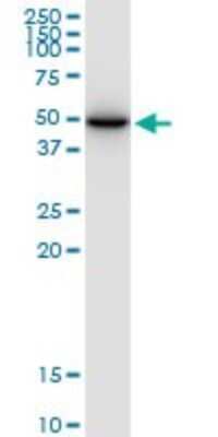 Western Blot: SLC25A24 Antibody [H00029957-B01P]
