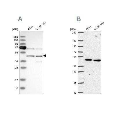 Western Blot: SLC25A24 Antibody [NBP1-89049]
