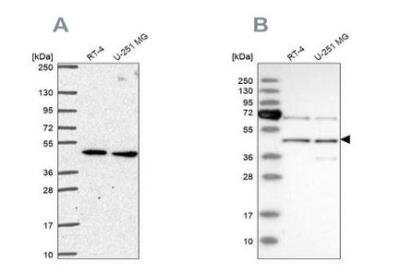 Western Blot: SLC25A24 Antibody [NBP2-57669]
