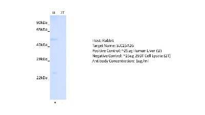 Western Blot: SLC25A26 Antibody [NBP2-83544]