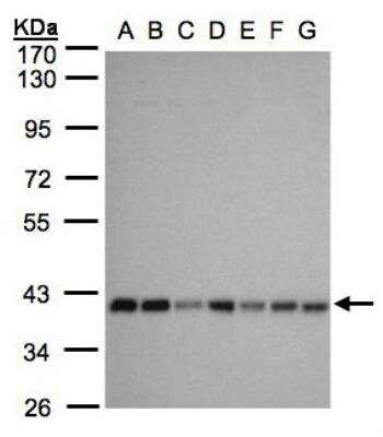 Western Blot: SLC25A33 Antibody [NBP1-32499]