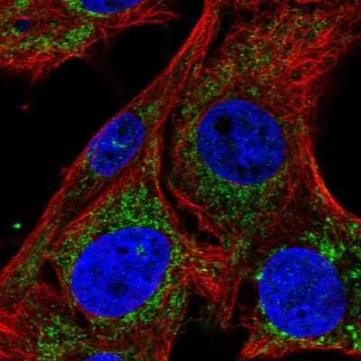 Immunocytochemistry/ Immunofluorescence: SLC25A34 Antibody [NBP2-55708]