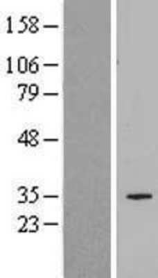 Western Blot: SLC25A34 Overexpression Lysate [NBL1-16063]