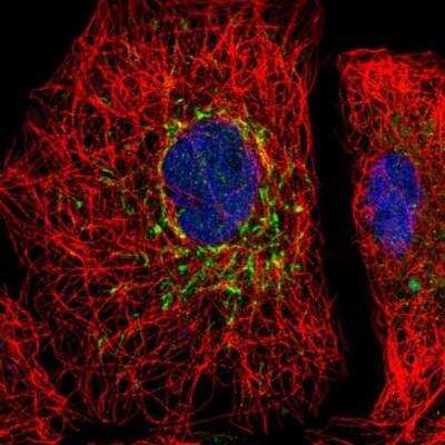 Immunocytochemistry/ Immunofluorescence: SLC25A35 Antibody [NBP2-13324]