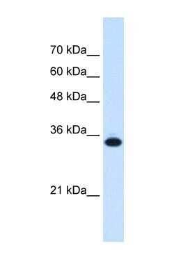 Western Blot: SLC25A38 Antibody [NBP1-59559]