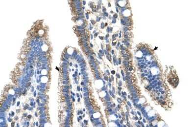 Immunohistochemistry-Paraffin: SLC25A39 Antibody [NBP1-59600]