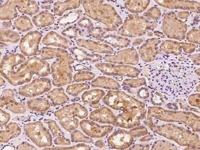 Immunohistochemistry-Paraffin: SLC25A42 Antibody [NBP2-98611]