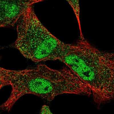 Immunocytochemistry/ Immunofluorescence: SLC25A45 Antibody [NBP2-30521]