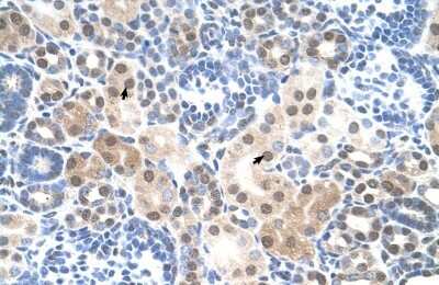 Immunohistochemistry-Paraffin: SLC25A45 Antibody [NBP1-59876]