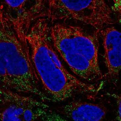 Immunocytochemistry/ Immunofluorescence: SLC25A46 Antibody [NBP2-58085]