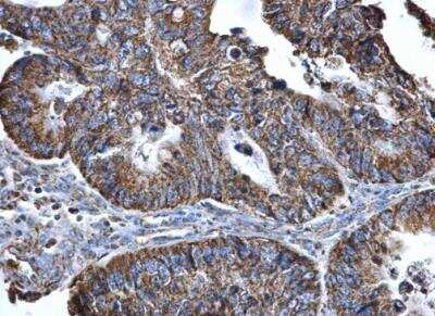 Immunohistochemistry-Paraffin: SLC25A6 Antibody [NBP2-20393]