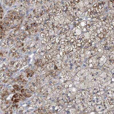 Immunohistochemistry-Paraffin: SLC26A11 Antibody [NBP1-86346]