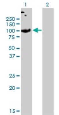 Western Blot: SLC26A2 Antibody (3F6) [H00001836-M04]